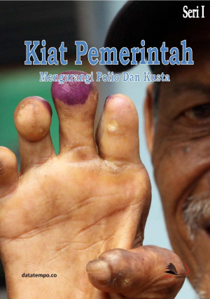 Kiat Pemerintah Menguragi Polio dan Kusta